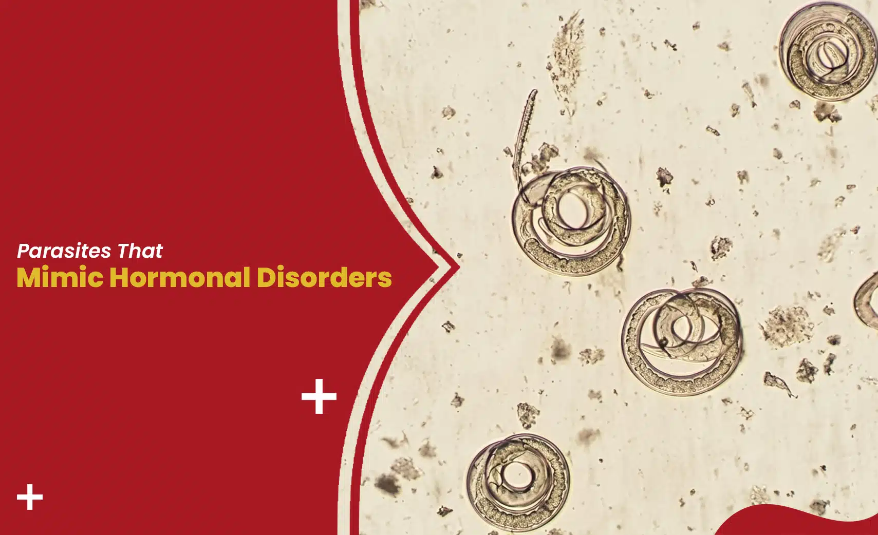 Parasites mimicking hormonal disorders