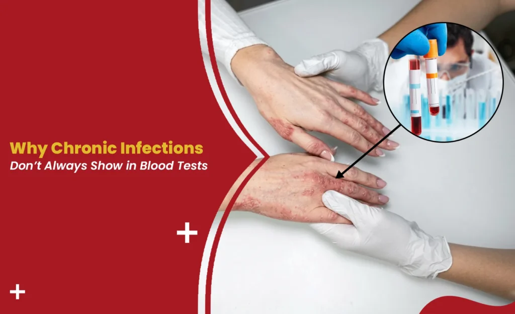 Doctor examining hand rash