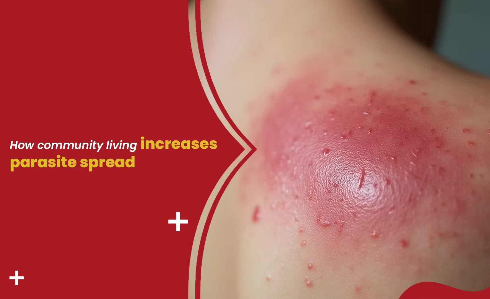 Parasite spread graphic