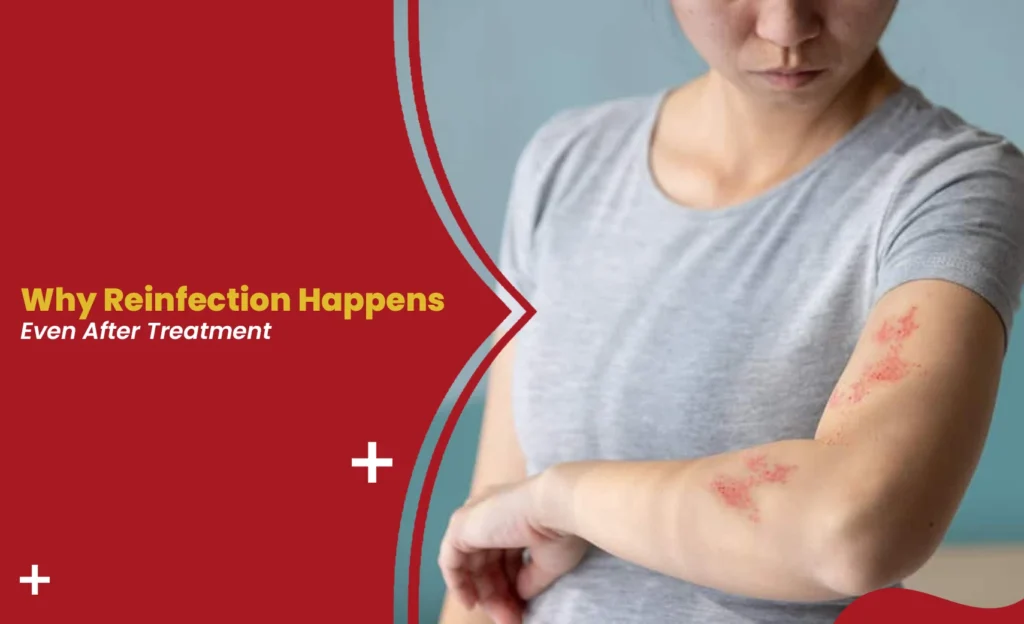 Skin rash reinfection graphic.
