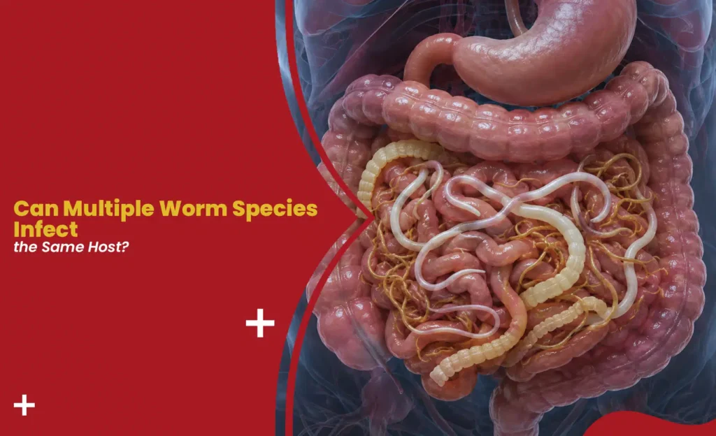 Illustration showing multiple worm species coexisting in the human intestine and digestive tract.