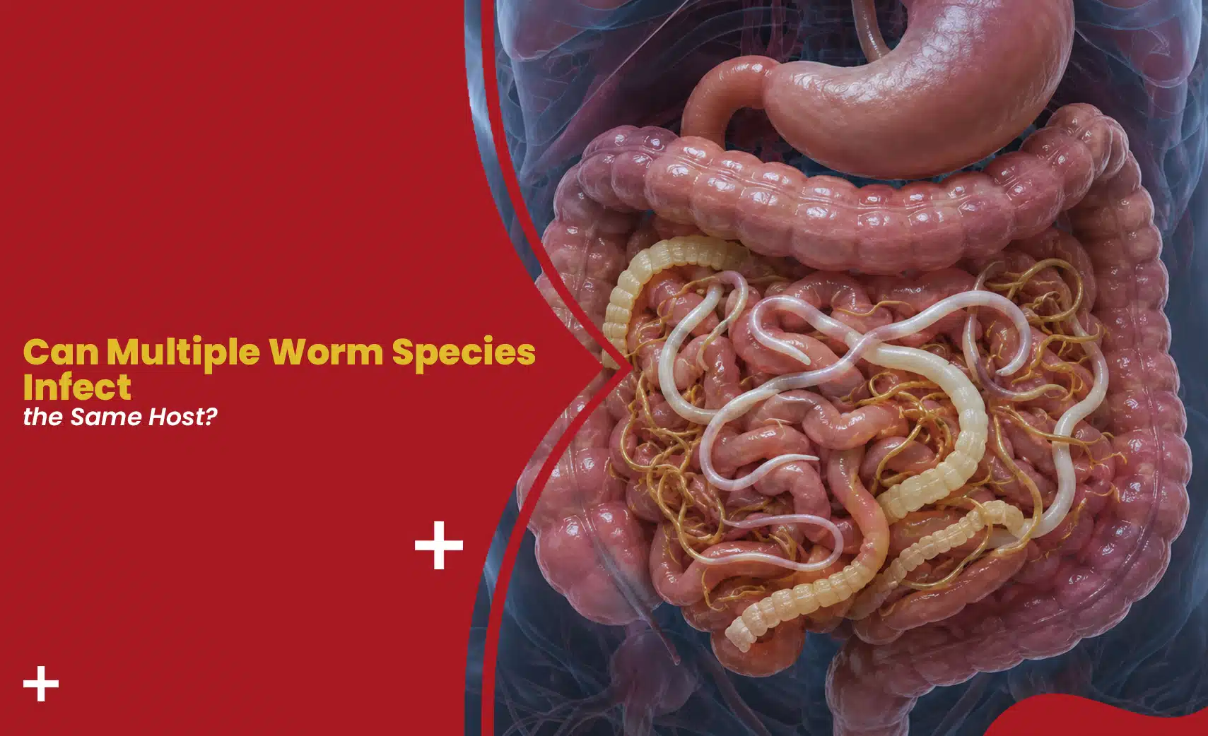 Illustration showing multiple worm species coexisting in the human intestine and digestive tract.
