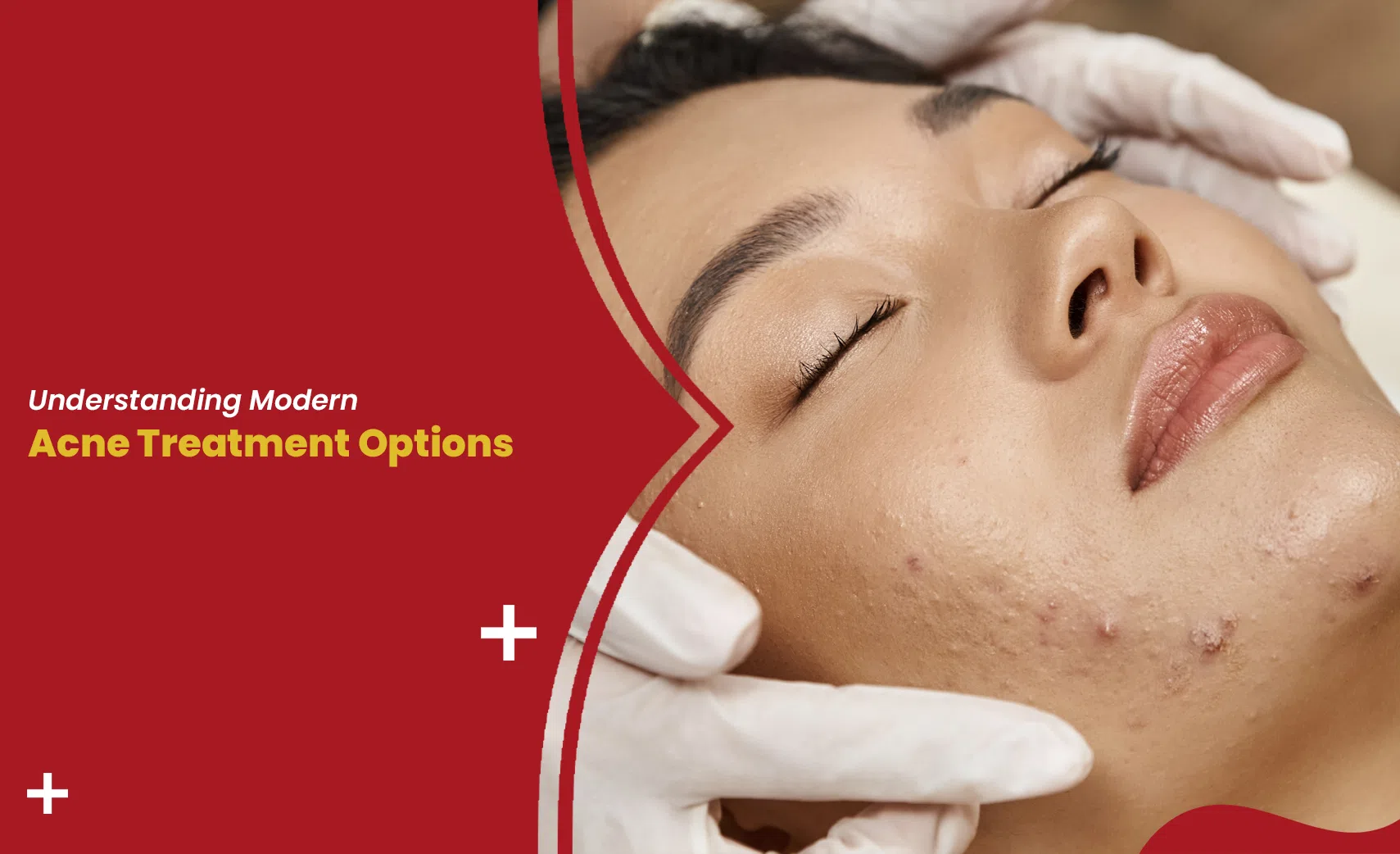 Dermatologist performing a professional acne treatment on a patient's face