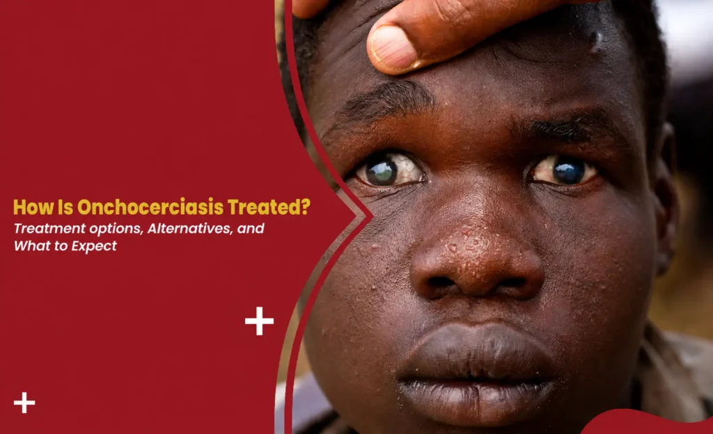 onchocerciasis treatment banner showing skin and eye symptoms of river blindness