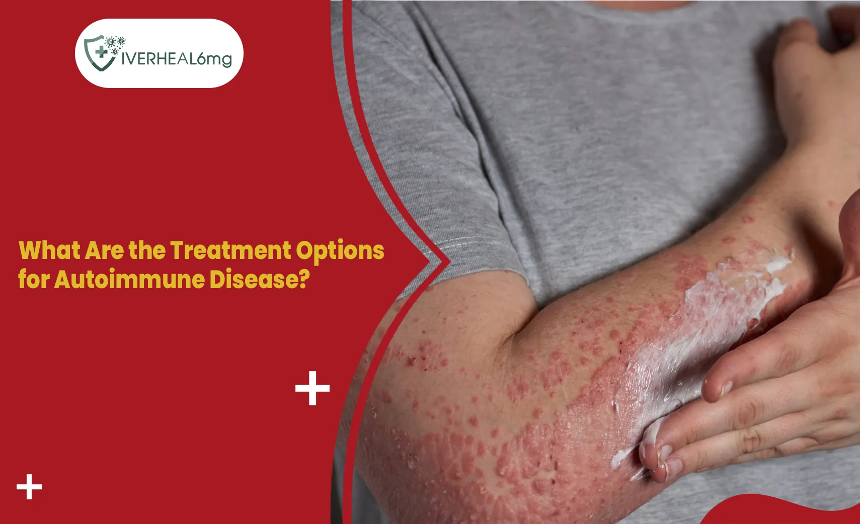 Autoimmune disease treatment options for managing inflammation and symptoms