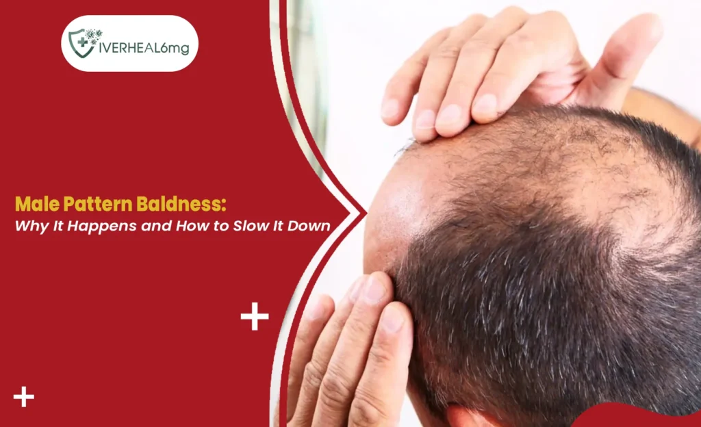Male pattern baldness and receding hairline